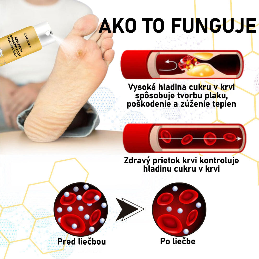 𝐶𝑉𝑅𝐸𝑂𝑍® 𝑆𝑝𝑟𝑒𝑗 𝑛𝑎 𝑙𝑖𝑒č𝑏𝑢 𝑑𝑖𝑎𝑏𝑒𝑡𝑖𝑐𝑘𝑒𝑗 𝑛𝑜ℎ𝑦 𝑠 𝑣č𝑒𝑙í𝑚 𝑗𝑒𝑑𝑜𝑚 🔥 𝐿𝑖𝑚𝑖𝑡𝑜𝑣𝑎𝑛á 𝑝𝑜𝑛𝑢𝑘𝑎 - 𝑧ľ𝑎𝑣𝑎 60 % 🔥