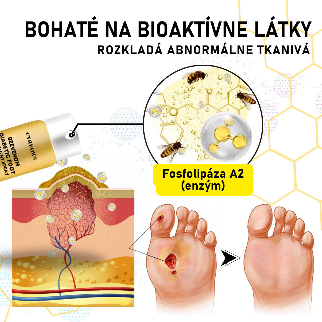 𝐶𝑉𝑅𝐸𝑂𝑍® 𝑆𝑝𝑟𝑒𝑗 𝑛𝑎 𝑙𝑖𝑒č𝑏𝑢 𝑑𝑖𝑎𝑏𝑒𝑡𝑖𝑐𝑘𝑒𝑗 𝑛𝑜ℎ𝑦 𝑠 𝑣č𝑒𝑙í𝑚 𝑗𝑒𝑑𝑜𝑚 🔥 𝐿𝑖𝑚𝑖𝑡𝑜𝑣𝑎𝑛á 𝑝𝑜𝑛𝑢𝑘𝑎 - 𝑧ľ𝑎𝑣𝑎 60 % 🔥