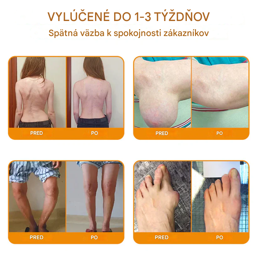 Ourlyard™🔥🐡 magnéziový olej a včelí jed v spreji na hojenie kĺbov👨⚕️Vyliečte bolesti kĺbov len za 4 týždne, bez efektu odrazu