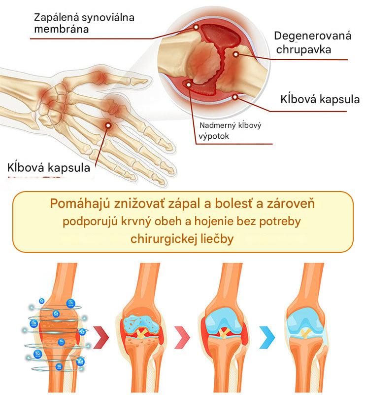 Ourlyard™🔥🐡 magnéziový olej a včelí jed v spreji na hojenie kĺbov👨⚕️Vyliečte bolesti kĺbov len za 4 týždne, bez efektu odrazu