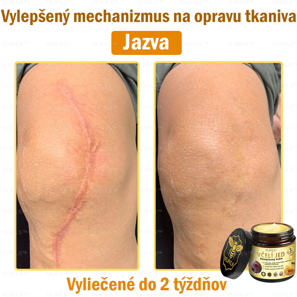 VLSVLS™ Krém z Včelieho Jedu s Komplexným Účinkom 🇸🇰 Odporúčaný Dermatológmi