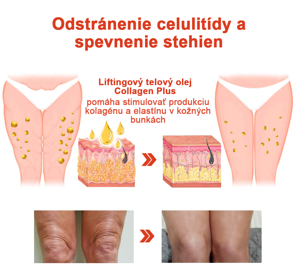 🌹 Magický Luxusný Telový Olej STDIE™ 🔥 Časovo Obmedzená Ponuka – Zľava 80 % ⏳ Posledných 30 Minút