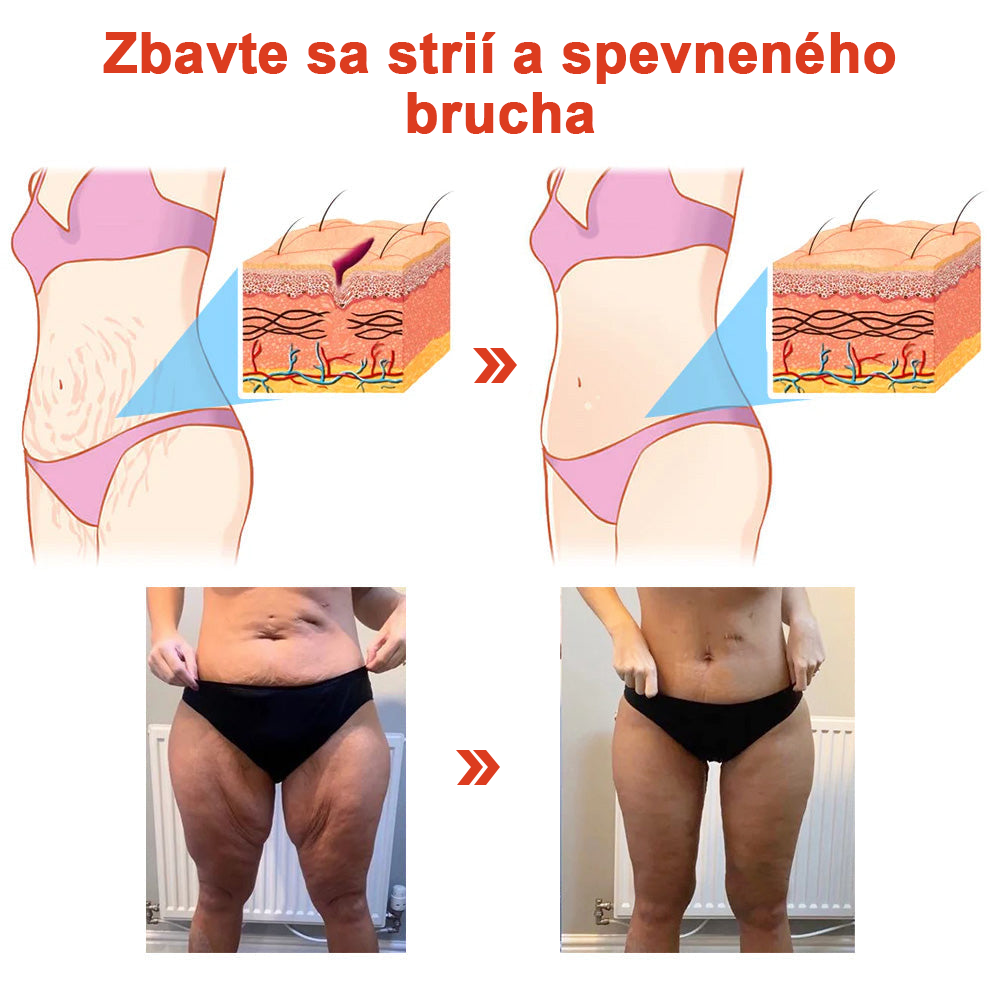 🌹 Magický Luxusný Telový Olej STDIE™ 🔥 Časovo Obmedzená Ponuka – Zľava 80 % ⏳ Posledných 30 Minút