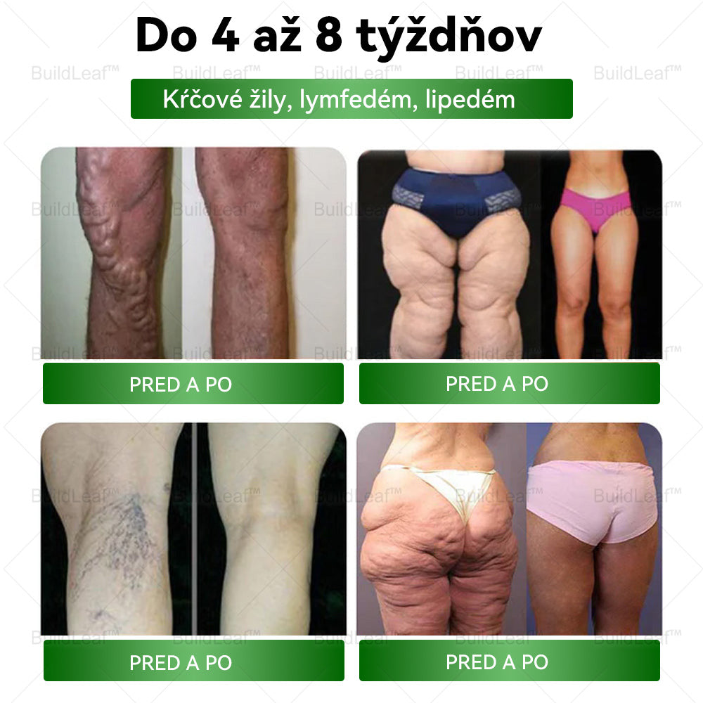 Odporúčané klinikou Mayo | Oficiálny obchod | BuildLeaf® GLP-1 Moringa Slimming & Health Boost Drops🔥 (Spaľovač tukov potravinárskej kvality – vyvinutý Spoločnosťou pre obezitu)