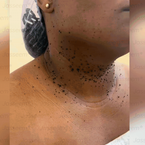 𝐉𝐚𝐬𝐬𝐞𝐞𝐦® ✅Pokročilé neinvazívne CO₂ laserové pero na opravu pokožky 💕 (Jemne odstraňuje bradavice, materské znamienka, starecké škvrny a kožné výrastky – bez bolesti, bez starostí!)