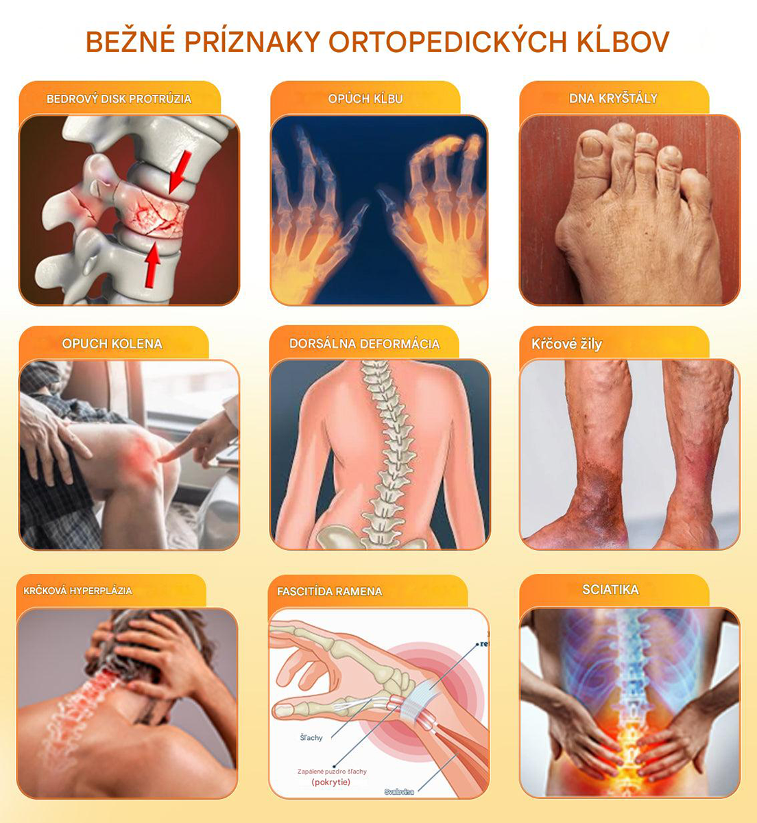 Ourlyard™🔥🐡 magnéziový olej a včelí jed v spreji na hojenie kĺbov👨⚕️Vyliečte bolesti kĺbov len za 4 týždne, bez efektu odrazu