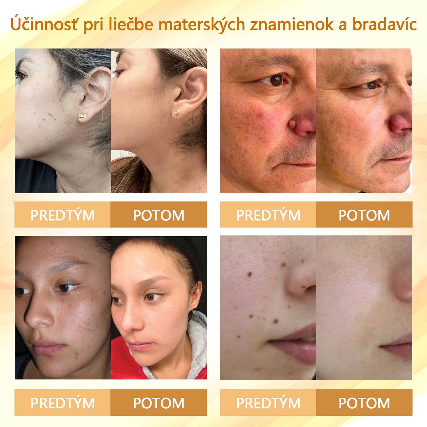 Regeneračný krém Croaie® Condense Mellifera Venom🔥