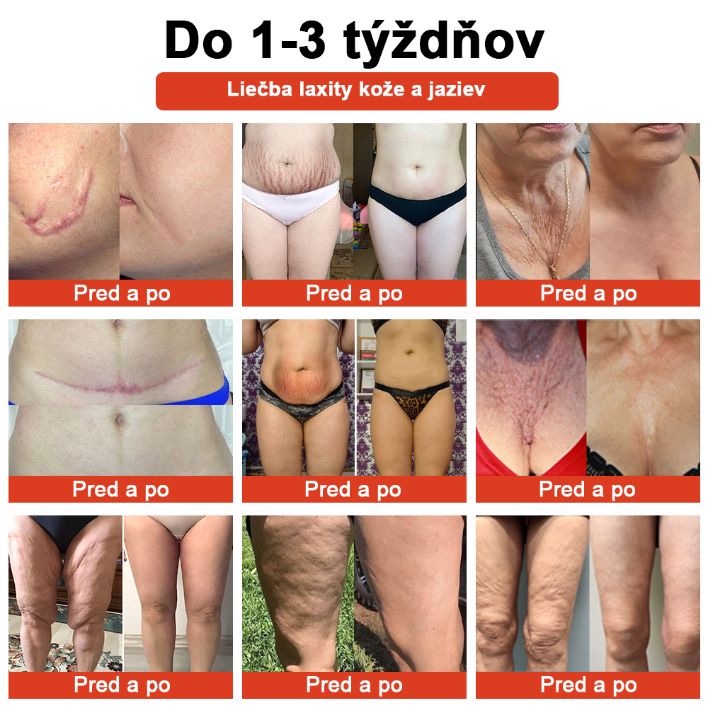 🌹 Magický Luxusný Telový Olej STDIE™ 🔥 Časovo Obmedzená Ponuka – Zľava 80 % ⏳ Posledných 30 Minút