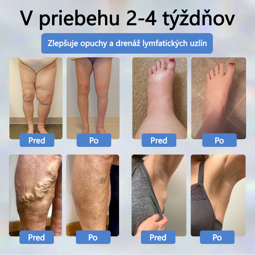 𝐴𝑇𝑇𝐷𝑋® 𝐵𝑦𝑙𝑖𝑛𝑛ý 𝑢𝑝𝑜𝑘𝑜𝑗𝑢𝑗ú𝑐𝑖 𝑘𝑟é𝑚 𝑝𝑟𝑜𝑡𝑖 𝑜𝑝𝑢𝑐ℎ𝑜𝑚 𝑠 č𝑖𝑒𝑟𝑛𝑜𝑢 𝑟𝑎𝑠𝑐𝑜𝑢