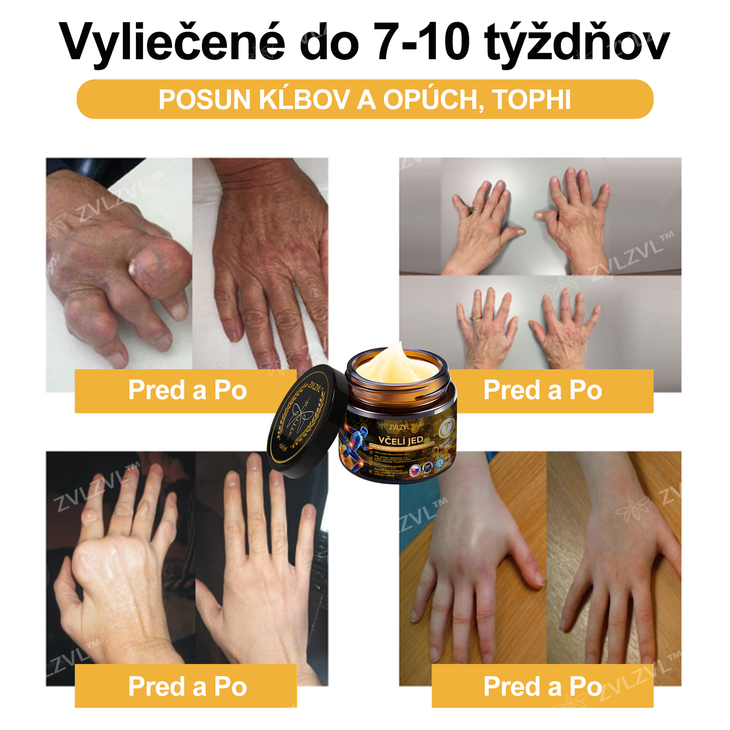 𝐎𝐟𝐢𝐜𝐢á𝐥𝐧𝐲 𝐨𝐛𝐜𝐡𝐨𝐝:𝐙𝐕𝐋𝐙𝐕𝐋™ 🐝𝐕č𝐞𝐥í 𝐣𝐞𝐝 𝐨𝐤𝐚𝐦ž𝐢𝐭ý 𝐮𝐥𝐭𝐫𝐚 𝐬𝐢𝐥𝐧ý 𝐤𝐫é𝐦 𝐩𝐫𝐨𝐭𝐢 𝐛𝐨𝐥𝐞𝐬𝐭𝐢 - (𝐳𝐦𝐢𝐞𝐫ň𝐮𝐣𝐞 𝐛𝐨𝐥𝐞𝐬ť 𝐩𝐫𝐢 𝐚𝐫𝐭𝐫𝐢𝐭í𝐝𝐞, 𝐛𝐨𝐥𝐞𝐬𝐭𝐢 𝐬𝐯𝐚𝐥𝐨𝐯, 𝐜𝐡𝐫𝐛𝐭𝐚, 𝐤𝐨𝐥𝐢𝐞𝐧, 𝐜𝐡𝐫𝐛𝐭𝐚, 𝐫𝐚𝐦𝐢𝐞𝐧, 𝐛𝐨𝐤𝐨𝐯, 𝐳á𝐩ä𝐬𝐭í, 𝐫ú𝐤)