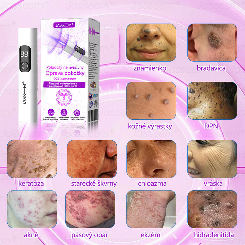 𝐉𝐚𝐬𝐬𝐞𝐞𝐦® ✅Pokročilé neinvazívne CO₂ laserové pero na opravu pokožky 💕 (Jemne odstraňuje bradavice, materské znamienka, starecké škvrny a kožné výrastky – bez bolesti, bez starostí!)