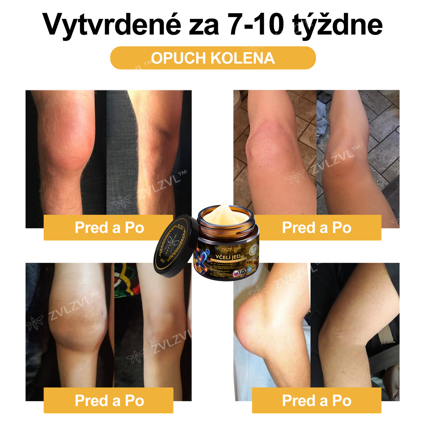 𝐎𝐟𝐢𝐜𝐢á𝐥𝐧𝐲 𝐨𝐛𝐜𝐡𝐨𝐝:𝐙𝐕𝐋𝐙𝐕𝐋™ 🐝𝐕č𝐞𝐥í 𝐣𝐞𝐝 𝐨𝐤𝐚𝐦ž𝐢𝐭ý 𝐮𝐥𝐭𝐫𝐚 𝐬𝐢𝐥𝐧ý 𝐤𝐫é𝐦 𝐩𝐫𝐨𝐭𝐢 𝐛𝐨𝐥𝐞𝐬𝐭𝐢 - (𝐳𝐦𝐢𝐞𝐫ň𝐮𝐣𝐞 𝐛𝐨𝐥𝐞𝐬ť 𝐩𝐫𝐢 𝐚𝐫𝐭𝐫𝐢𝐭í𝐝𝐞, 𝐛𝐨𝐥𝐞𝐬𝐭𝐢 𝐬𝐯𝐚𝐥𝐨𝐯, 𝐜𝐡𝐫𝐛𝐭𝐚, 𝐤𝐨𝐥𝐢𝐞𝐧, 𝐜𝐡𝐫𝐛𝐭𝐚, 𝐫𝐚𝐦𝐢𝐞𝐧, 𝐛𝐨𝐤𝐨𝐯, 𝐳á𝐩ä𝐬𝐭í, 𝐫ú𝐤)