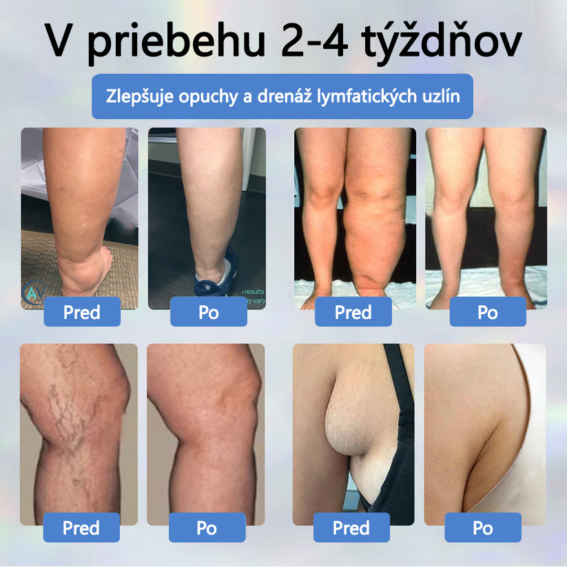 𝐴𝑇𝑇𝐷𝑋® 𝐵𝑦𝑙𝑖𝑛𝑛ý 𝑢𝑝𝑜𝑘𝑜𝑗𝑢𝑗ú𝑐𝑖 𝑘𝑟é𝑚 𝑝𝑟𝑜𝑡𝑖 𝑜𝑝𝑢𝑐ℎ𝑜𝑚 𝑠 č𝑖𝑒𝑟𝑛𝑜𝑢 𝑟𝑎𝑠𝑐𝑜𝑢