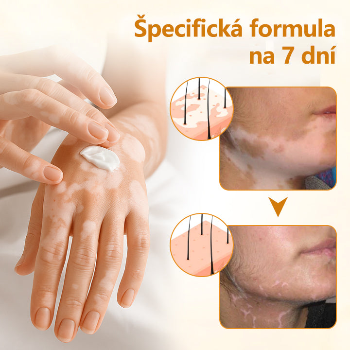 𝑇𝑖𝑚𝑖𝑙𝑘®✅ 𝑉𝑖𝑡𝑖𝐶𝑎𝑙𝑚 – 𝑉𝑖𝑑𝑖𝑡𝑒ľ𝑛é 𝑧𝑙𝑒𝑝š𝑒𝑛𝑖𝑒 𝑣𝑖𝑡𝑖𝑙𝑖𝑔𝑎 𝑢ž 𝑧𝑎 7 𝑑𝑛í! 𝑍𝑏𝑎𝑣𝑡𝑒 𝑠𝑎 𝑏𝑖𝑒𝑙𝑦𝑐ℎ š𝑘𝑣ŕ𝑛 𝑏𝑒𝑧 𝑐ℎ𝑒𝑚𝑖𝑘á𝑙𝑖í.