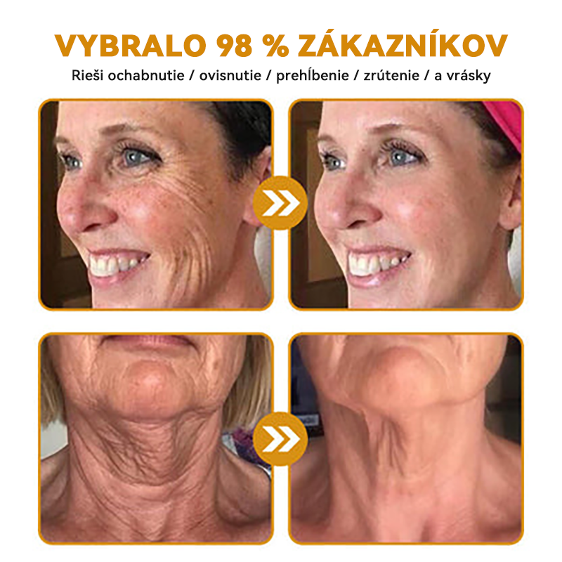 ( ✅Oficiálny obchod ) Spzv™ 𝐁𝐨𝐭𝐨𝐱 krém proti vráskam (Exkluzívna ponuka - Nezmeškajte to)