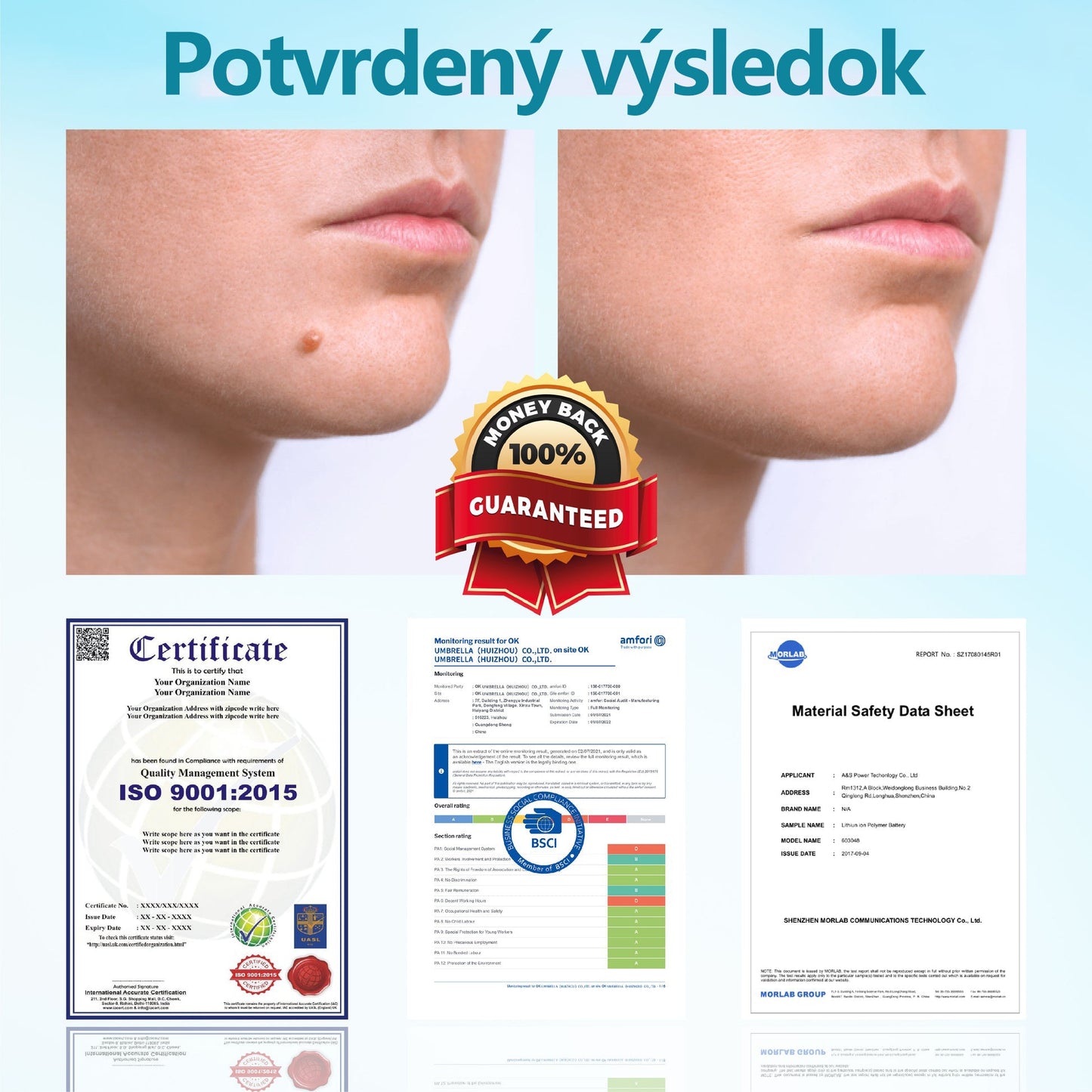 RICPIND®✨ Neinvazívne laserové pero na odstránenie znamienok a bradavíc