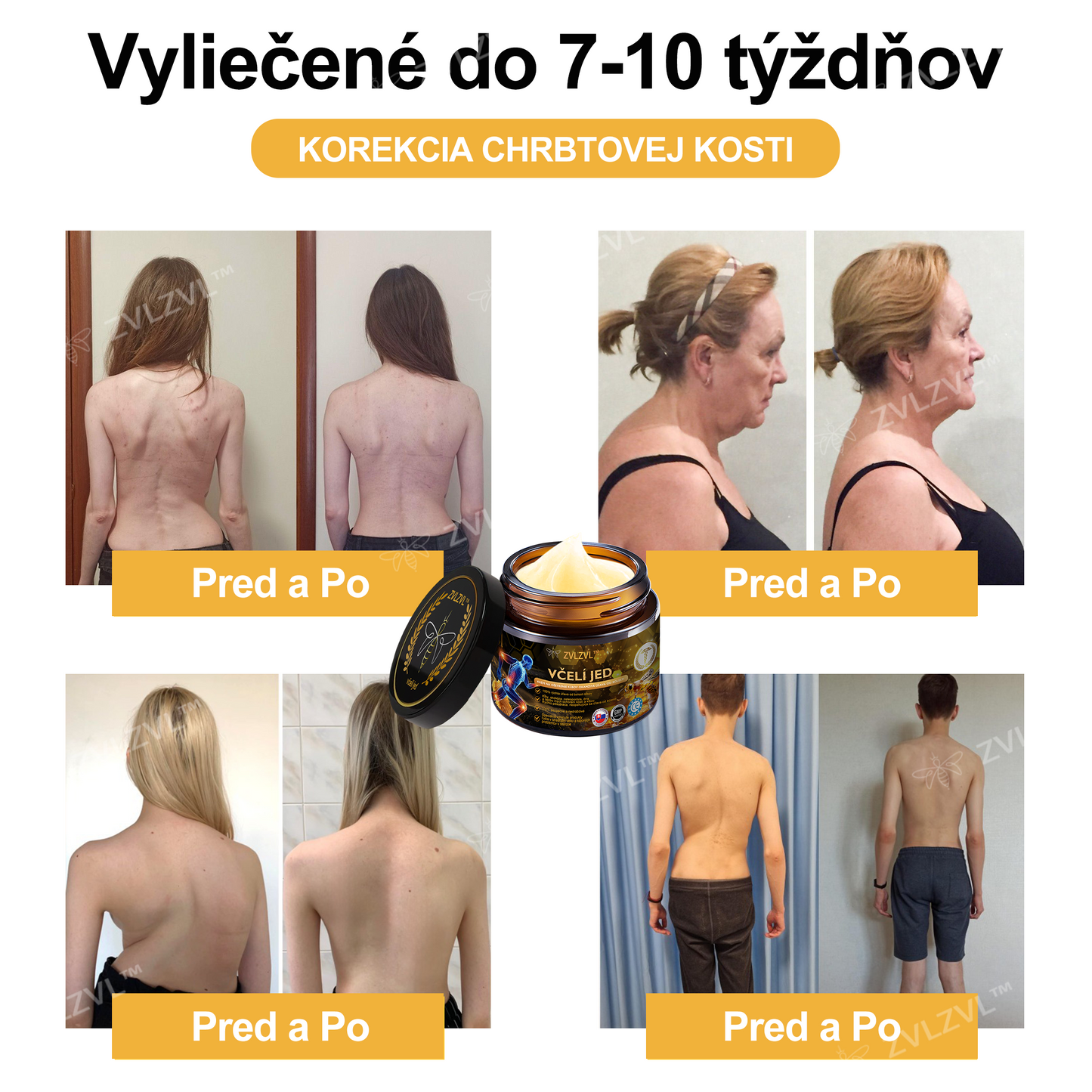 𝐎𝐟𝐢𝐜𝐢á𝐥𝐧𝐲 𝐨𝐛𝐜𝐡𝐨𝐝:𝐙𝐕𝐋𝐙𝐕𝐋™ 🐝𝐕č𝐞𝐥í 𝐣𝐞𝐝 𝐨𝐤𝐚𝐦ž𝐢𝐭ý 𝐮𝐥𝐭𝐫𝐚 𝐬𝐢𝐥𝐧ý 𝐤𝐫é𝐦 𝐩𝐫𝐨𝐭𝐢 𝐛𝐨𝐥𝐞𝐬𝐭𝐢 - (𝐳𝐦𝐢𝐞𝐫ň𝐮𝐣𝐞 𝐛𝐨𝐥𝐞𝐬ť 𝐩𝐫𝐢 𝐚𝐫𝐭𝐫𝐢𝐭í𝐝𝐞, 𝐛𝐨𝐥𝐞𝐬𝐭𝐢 𝐬𝐯𝐚𝐥𝐨𝐯, 𝐜𝐡𝐫𝐛𝐭𝐚, 𝐤𝐨𝐥𝐢𝐞𝐧, 𝐜𝐡𝐫𝐛𝐭𝐚, 𝐫𝐚𝐦𝐢𝐞𝐧, 𝐛𝐨𝐤𝐨𝐯, 𝐳á𝐩ä𝐬𝐭í, 𝐫ú𝐤)