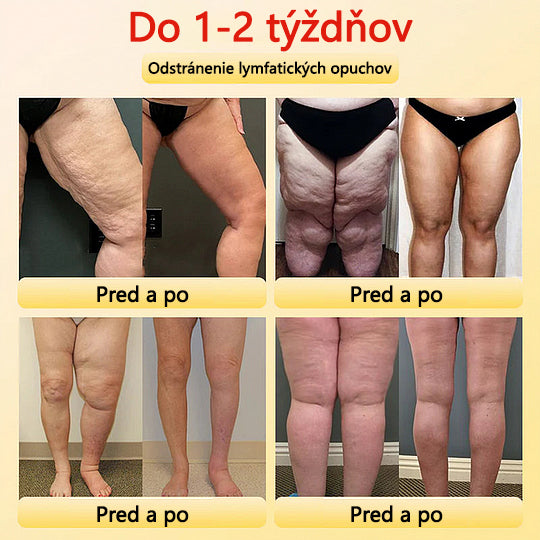 🎉 Časovo obmedzená ponuka – obrovská zľava! 🔥🔥ZĽAVA až 90 %!💰 Sfrcord™ titánové vlákno samozahrievacie turmalínové tvarujúce šortky
