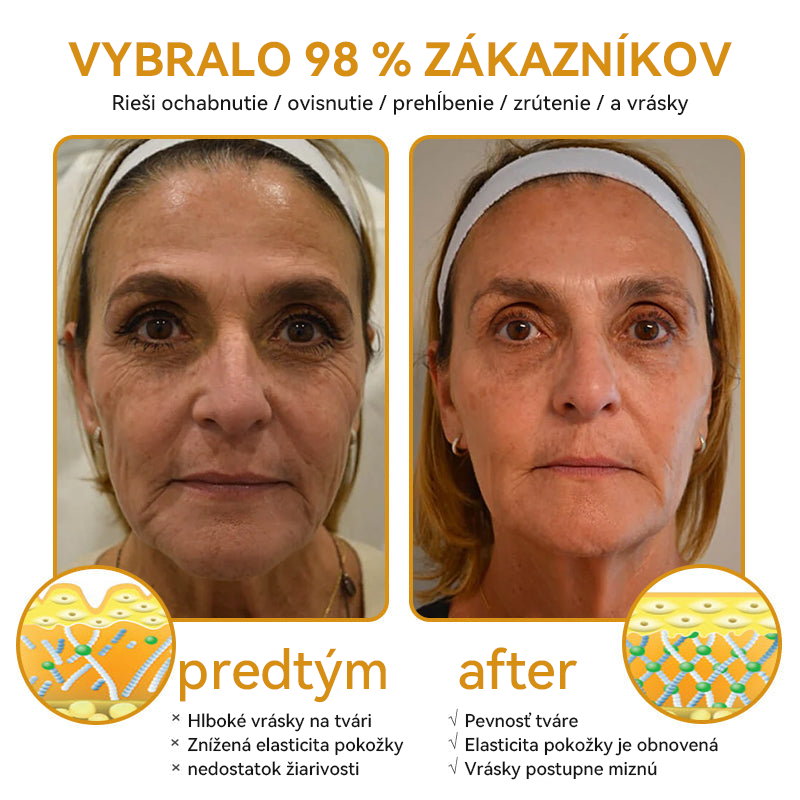 ( ✅Oficiálny obchod ) Spzv™ 𝐁𝐨𝐭𝐨𝐱 krém proti vráskam (Exkluzívna ponuka - Nezmeškajte to)