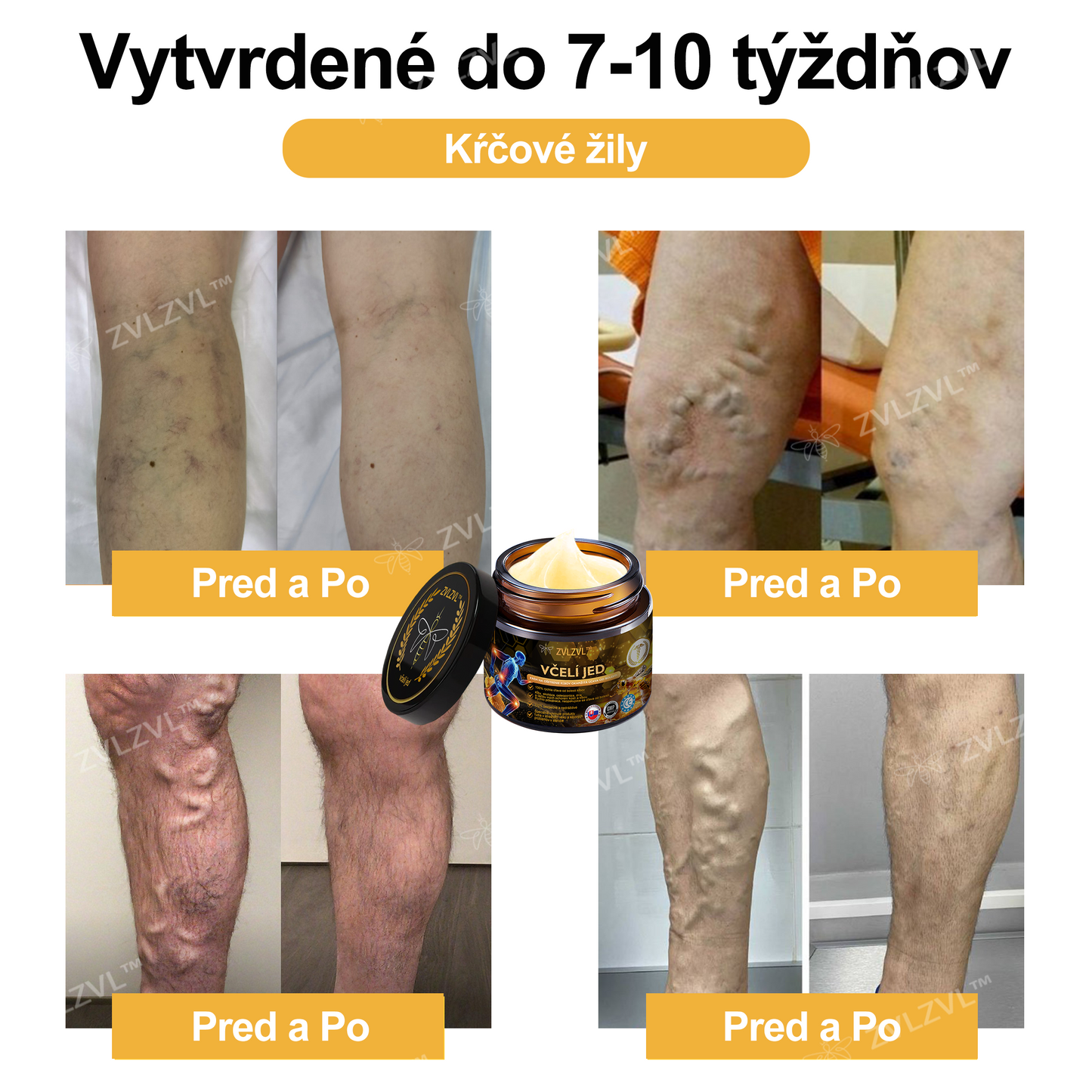 𝐎𝐟𝐢𝐜𝐢á𝐥𝐧𝐲 𝐨𝐛𝐜𝐡𝐨𝐝:𝐙𝐕𝐋𝐙𝐕𝐋™ 🐝𝐕č𝐞𝐥í 𝐣𝐞𝐝 𝐨𝐤𝐚𝐦ž𝐢𝐭ý 𝐮𝐥𝐭𝐫𝐚 𝐬𝐢𝐥𝐧ý 𝐤𝐫é𝐦 𝐩𝐫𝐨𝐭𝐢 𝐛𝐨𝐥𝐞𝐬𝐭𝐢 - (𝐳𝐦𝐢𝐞𝐫ň𝐮𝐣𝐞 𝐛𝐨𝐥𝐞𝐬ť 𝐩𝐫𝐢 𝐚𝐫𝐭𝐫𝐢𝐭í𝐝𝐞, 𝐛𝐨𝐥𝐞𝐬𝐭𝐢 𝐬𝐯𝐚𝐥𝐨𝐯, 𝐜𝐡𝐫𝐛𝐭𝐚, 𝐤𝐨𝐥𝐢𝐞𝐧, 𝐜𝐡𝐫𝐛𝐭𝐚, 𝐫𝐚𝐦𝐢𝐞𝐧, 𝐛𝐨𝐤𝐨𝐯, 𝐳á𝐩ä𝐬𝐭í, 𝐫ú𝐤)