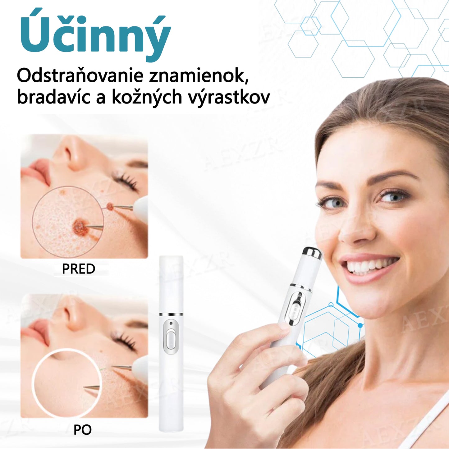 🎉 50 % zľava len na obmedzený čas! Bikenda® Neinvazívne laserové pero Bezbolestné odstránenie znamienok, bradavíc a škvŕn priamo u vás doma! 💕ie znamienok, bradavíc a škvŕn priamo u vás doma! 💕