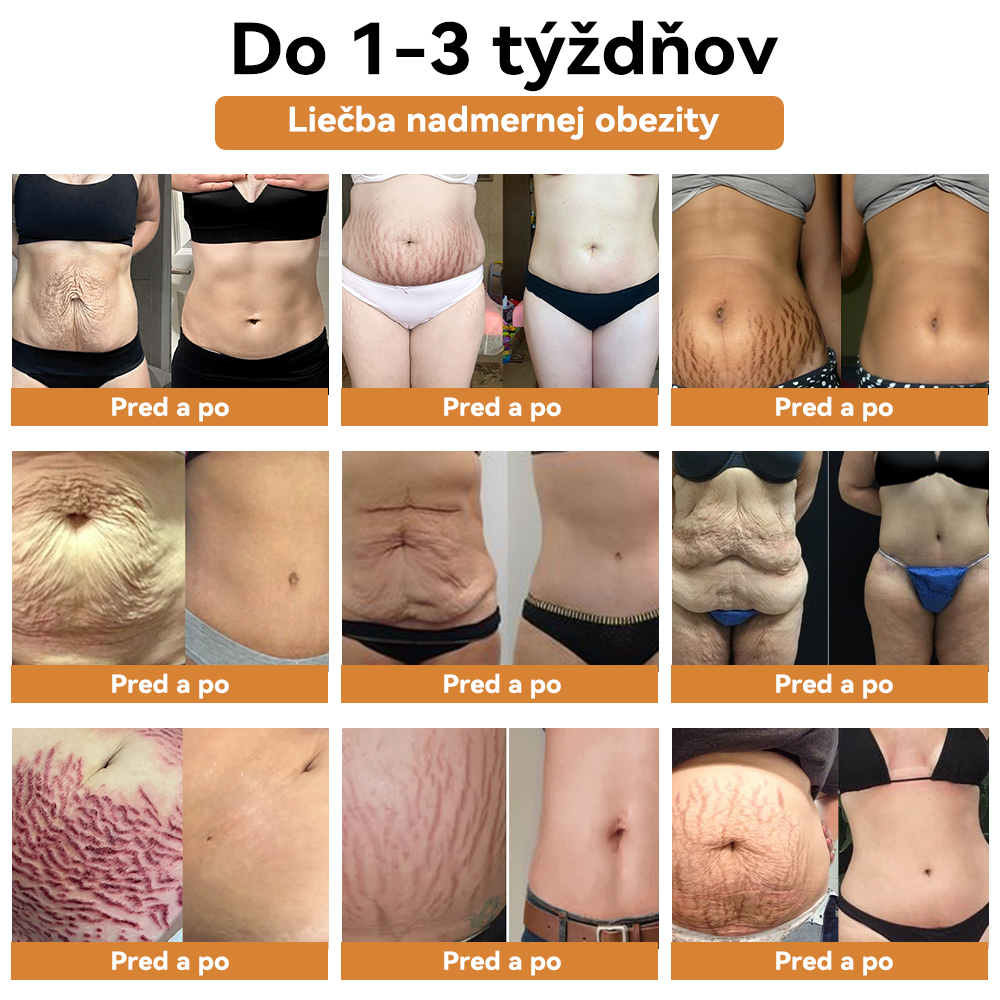𝐙ľ𝐚𝐯𝐚 𝐧𝐚 𝐩𝐨𝐬𝐥𝐞𝐝𝐧ý 𝐝𝐞ň: 𝟕𝟓% 𝐙Ľ𝐀𝐕𝐀👑𝐕𝐎𝐂𝐉𝐅𝐄𝐈™ 𝐊𝐚𝐫𝐛𝐨𝐧𝐨𝐯é 𝐧𝐚𝐧𝐨 𝐭𝐞𝐫𝐦𝐨-𝐬𝐞𝐧𝐳𝐨𝐫𝐢𝐜𝐤é 𝐯𝐥á𝐤𝐧𝐨 𝐈ó𝐧𝐨𝐯é 𝐝𝐞𝐭𝐨𝐱𝐢𝐤𝐚č𝐧é 𝐭𝐯𝐚𝐫𝐨𝐯𝐚𝐜𝐢𝐞 š𝐨𝐫𝐭𝐤𝐲