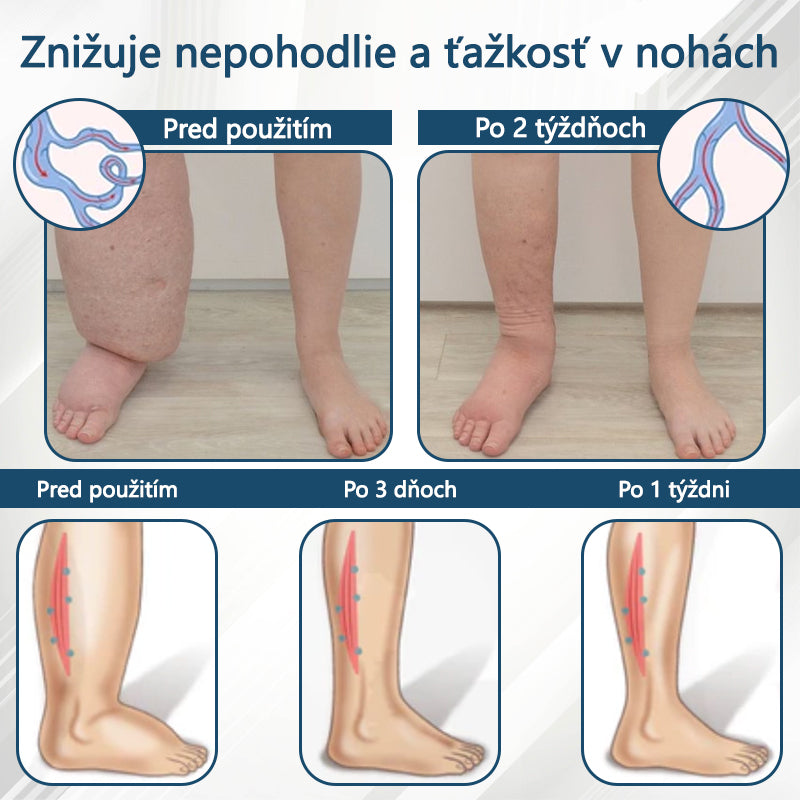 𝐴𝑇𝑇𝐷𝑋® 𝐵𝑦𝑙𝑖𝑛𝑛ý 𝑢𝑝𝑜𝑘𝑜𝑗𝑢𝑗ú𝑐𝑖 𝑘𝑟é𝑚 𝑝𝑟𝑜𝑡𝑖 𝑜𝑝𝑢𝑐ℎ𝑜𝑚 𝑠 č𝑖𝑒𝑟𝑛𝑜𝑢 𝑟𝑎𝑠𝑐𝑜𝑢