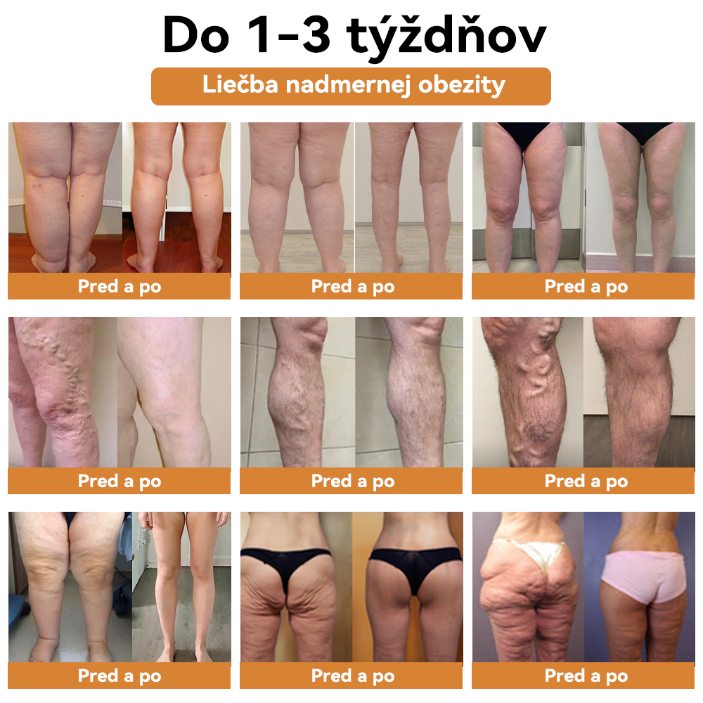 𝐙ľ𝐚𝐯𝐚 𝐧𝐚 𝐩𝐨𝐬𝐥𝐞𝐝𝐧ý 𝐝𝐞ň: 𝟕𝟓% 𝐙Ľ𝐀𝐕𝐀👑𝐕𝐎𝐂𝐉𝐅𝐄𝐈™ 𝐊𝐚𝐫𝐛𝐨𝐧𝐨𝐯é 𝐧𝐚𝐧𝐨 𝐭𝐞𝐫𝐦𝐨-𝐬𝐞𝐧𝐳𝐨𝐫𝐢𝐜𝐤é 𝐯𝐥á𝐤𝐧𝐨 𝐈ó𝐧𝐨𝐯é 𝐝𝐞𝐭𝐨𝐱𝐢𝐤𝐚č𝐧é 𝐭𝐯𝐚𝐫𝐨𝐯𝐚𝐜𝐢𝐞 š𝐨𝐫𝐭𝐤𝐲