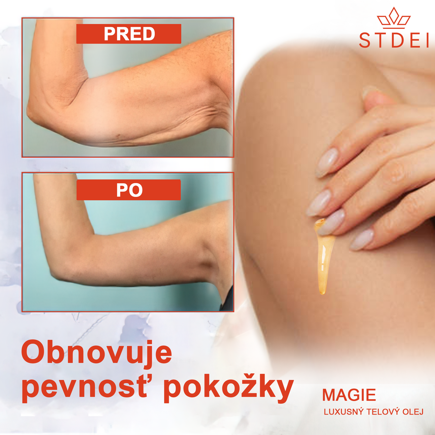🌹 Magický Luxusný Telový Olej STDIE™ 🔥 Časovo Obmedzená Ponuka – Zľava 80 % ⏳ Posledných 30 Minút
