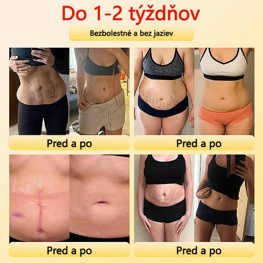 🎉 Časovo obmedzená ponuka – obrovská zľava! 🔥🔥ZĽAVA až 90 %!💰 Sfrcord™ titánové vlákno samozahrievacie turmalínové tvarujúce šortky