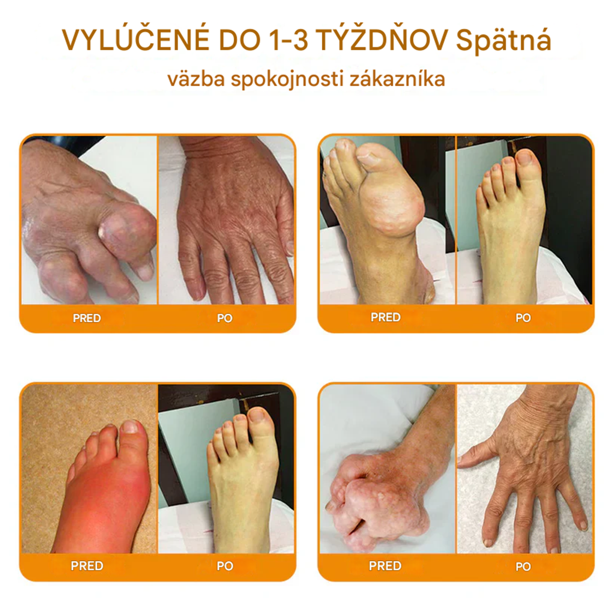 Ourlyard™🔥🐡 magnéziový olej a včelí jed v spreji na hojenie kĺbov👨⚕️Vyliečte bolesti kĺbov len za 4 týždne, bez efektu odrazu