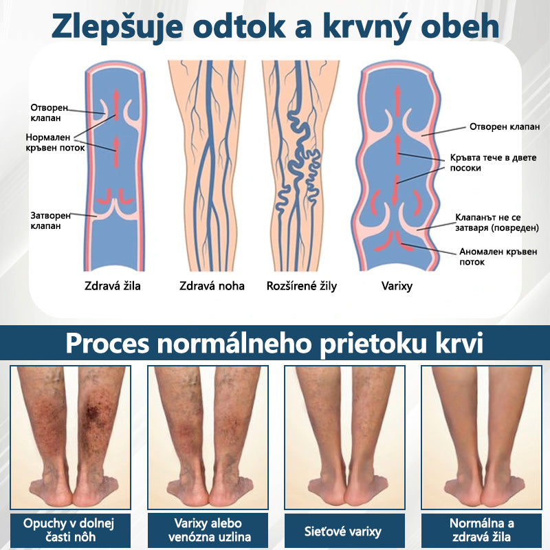 𝐴𝑇𝑇𝐷𝑋® 𝐵𝑦𝑙𝑖𝑛𝑛ý 𝑢𝑝𝑜𝑘𝑜𝑗𝑢𝑗ú𝑐𝑖 𝑘𝑟é𝑚 𝑝𝑟𝑜𝑡𝑖 𝑜𝑝𝑢𝑐ℎ𝑜𝑚 𝑠 č𝑖𝑒𝑟𝑛𝑜𝑢 𝑟𝑎𝑠𝑐𝑜𝑢
