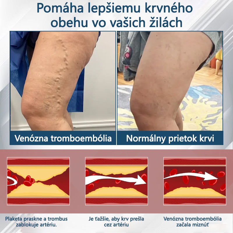 𝐴𝑇𝑇𝐷𝑋® 𝐵𝑦𝑙𝑖𝑛𝑛ý 𝑢𝑝𝑜𝑘𝑜𝑗𝑢𝑗ú𝑐𝑖 𝑘𝑟é𝑚 𝑝𝑟𝑜𝑡𝑖 𝑜𝑝𝑢𝑐ℎ𝑜𝑚 𝑠 č𝑖𝑒𝑟𝑛𝑜𝑢 𝑟𝑎𝑠𝑐𝑜𝑢