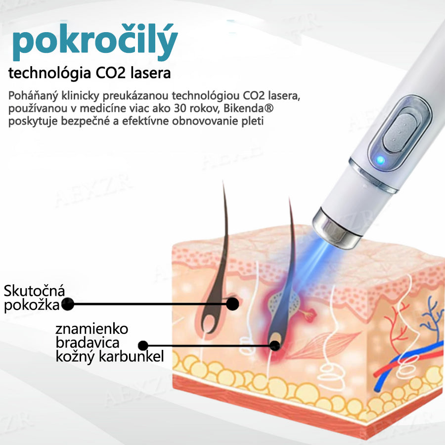 🎉 50 % zľava len na obmedzený čas! Bikenda® Neinvazívne laserové pero Bezbolestné odstránenie znamienok, bradavíc a škvŕn priamo u vás doma! 💕ie znamienok, bradavíc a škvŕn priamo u vás doma! 💕