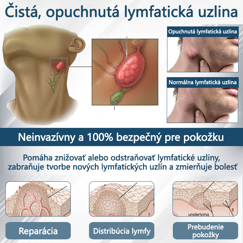 𝐴𝑇𝑇𝐷𝑋® 𝐵𝑦𝑙𝑖𝑛𝑛ý 𝑢𝑝𝑜𝑘𝑜𝑗𝑢𝑗ú𝑐𝑖 𝑘𝑟é𝑚 𝑝𝑟𝑜𝑡𝑖 𝑜𝑝𝑢𝑐ℎ𝑜𝑚 𝑠 č𝑖𝑒𝑟𝑛𝑜𝑢 𝑟𝑎𝑠𝑐𝑜𝑢