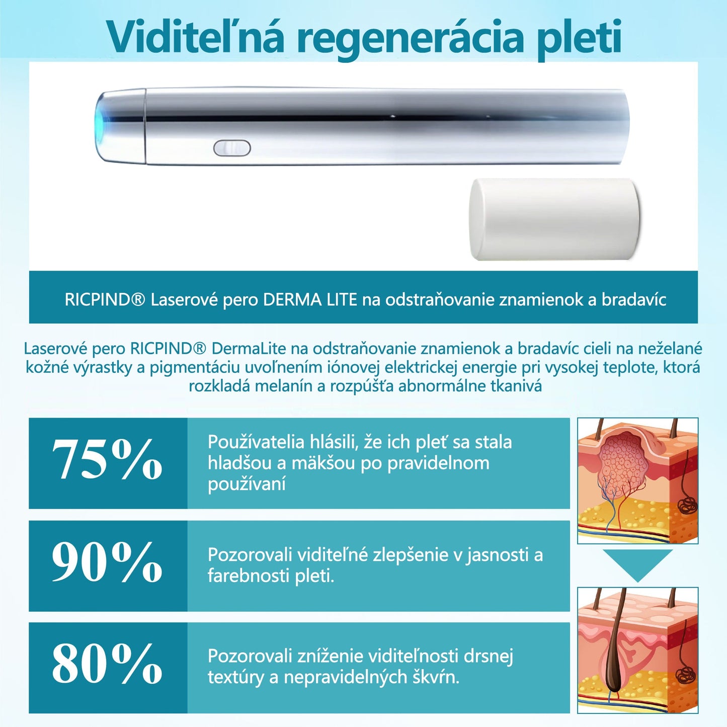RICPIND®✨ Neinvazívne laserové pero na odstránenie znamienok a bradavíc