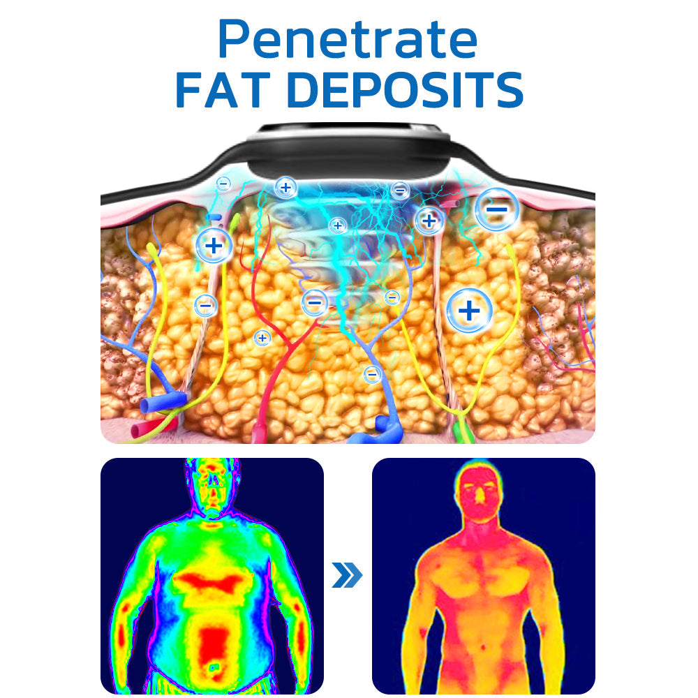 🌟Registrované v CSA | Ultrazvukový náramok na otryskávanie a detoxikáciu tuku GFOUK™ (🔥POSLEDNÝ DEŇ 70% ZĽAVA)