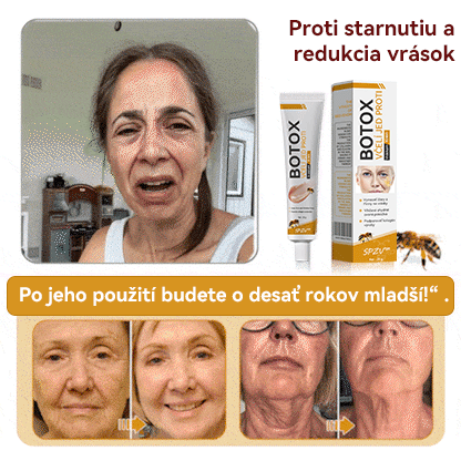 ( ✅Oficiálny obchod ) Spzv™ 𝐁𝐨𝐭𝐨𝐱 krém proti vráskam (Exkluzívna ponuka - Nezmeškajte to)