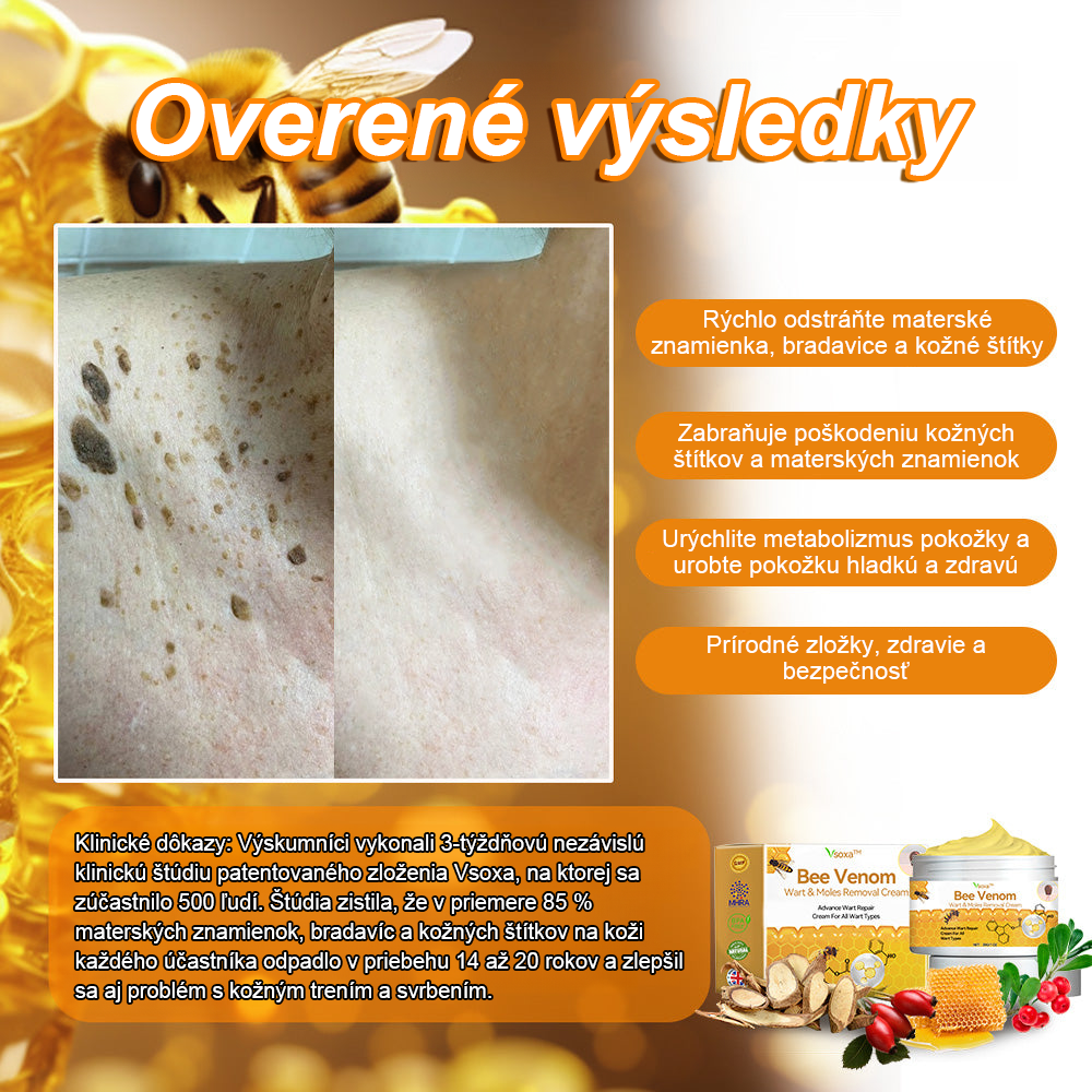🔥Vsoxa™ Krém na odstránenie bradavíc a krtkov s obsahom včelieho jedu (zľava 80%)