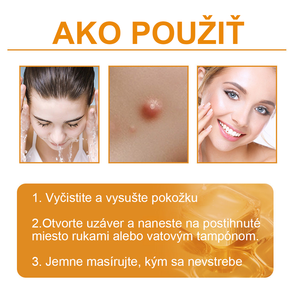 🔥Vsoxa™ Krém na odstránenie bradavíc a krtkov s obsahom včelieho jedu (zľava 80%)