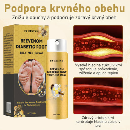 𝐶𝑉𝑅𝐸𝑂𝑍®✨ 𝑆𝑝𝑟𝑒𝑗 𝑛𝑎 𝑙𝑖𝑒č𝑏𝑢 𝑑𝑖𝑎𝑏𝑒𝑡𝑖𝑐𝑘𝑒𝑗 𝑛𝑜ℎ𝑦 𝑠 𝑣č𝑒𝑙í𝑚 𝑗𝑒𝑑𝑜𝑚 🔥 𝐿𝑖𝑚𝑖𝑡𝑜𝑣𝑎𝑛á 𝑝𝑜𝑛𝑢𝑘𝑎 - 𝑧ľ𝑎𝑣𝑎 60 % 🔥
