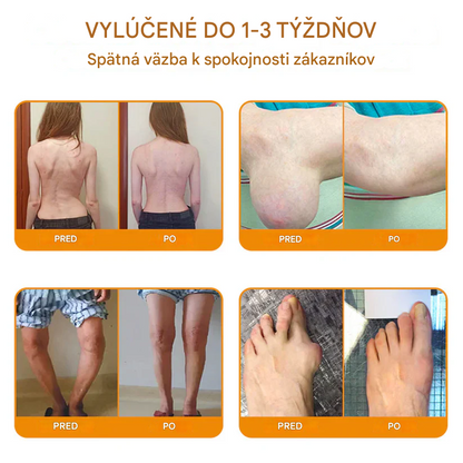Ourlyard™🔥🐡 magnéziový olej a včelí jed v spreji na hojenie kĺbov👨‍⚕️Vyliečte bolesti kĺbov len za 4 týždne, bez efektu odrazu