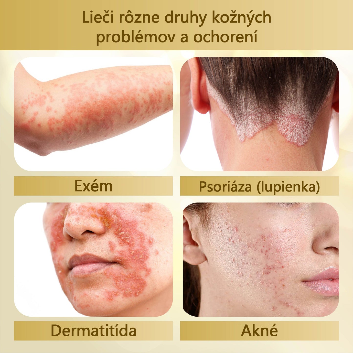Regeneračný krém Croaie® Condense Mellifera Venom🔥