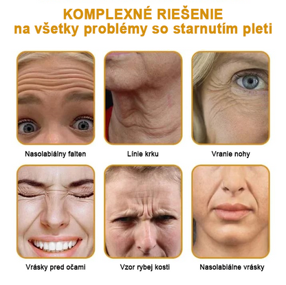 🍀Posledný deň akcie: 70% zľava - ✨Furzero™ Botoxový krém na odstránenie vrások od včelieho jedu