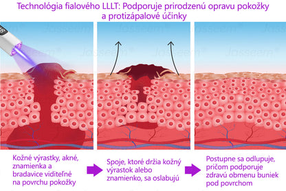 𝐉𝐚𝐬𝐬𝐞𝐞𝐦® ✅Pokročilé neinvazívne CO₂ laserové pero na opravu pokožky 💕 (Jemne odstraňuje bradavice, materské znamienka, starecké škvrny a kožné výrastky – bez bolesti, bez starostí!)