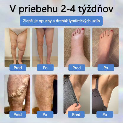 𝐴𝑇𝑇𝐷𝑋® 𝐵𝑦𝑙𝑖𝑛𝑛ý 𝑢𝑝𝑜𝑘𝑜𝑗𝑢𝑗ú𝑐𝑖 𝑘𝑟é𝑚 𝑝𝑟𝑜𝑡𝑖 𝑜𝑝𝑢𝑐ℎ𝑜𝑚 𝑠 č𝑖𝑒𝑟𝑛𝑜𝑢 𝑟𝑎𝑠𝑐𝑜𝑢