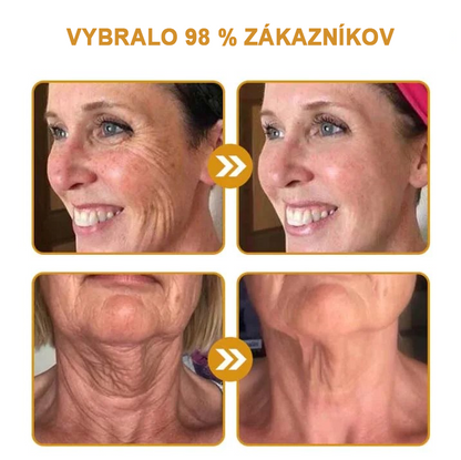 🍀Posledný deň akcie: 70% zľava - ✨Furzero™ Botoxový krém na odstránenie vrások od včelieho jedu