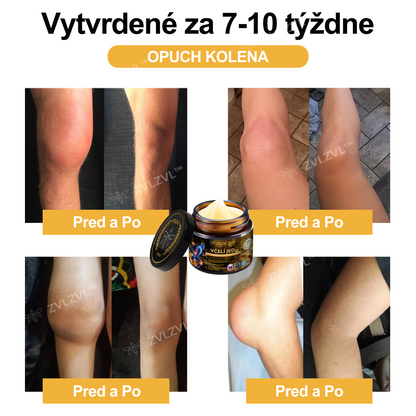 𝐎𝐟𝐢𝐜𝐢á𝐥𝐧𝐲 𝐨𝐛𝐜𝐡𝐨𝐝:𝐙𝐕𝐋𝐙𝐕𝐋™ 🐝𝐕č𝐞𝐥í 𝐣𝐞𝐝 𝐨𝐤𝐚𝐦ž𝐢𝐭ý 𝐮𝐥𝐭𝐫𝐚 𝐬𝐢𝐥𝐧ý 𝐤𝐫é𝐦 𝐩𝐫𝐨𝐭𝐢 𝐛𝐨𝐥𝐞𝐬𝐭𝐢 - (𝐳𝐦𝐢𝐞𝐫ň𝐮𝐣𝐞 𝐛𝐨𝐥𝐞𝐬ť 𝐩𝐫𝐢 𝐚𝐫𝐭𝐫𝐢𝐭í𝐝𝐞, 𝐛𝐨𝐥𝐞𝐬𝐭𝐢 𝐬𝐯𝐚𝐥𝐨𝐯, 𝐜𝐡𝐫𝐛𝐭𝐚, 𝐤𝐨𝐥𝐢𝐞𝐧, 𝐜𝐡𝐫𝐛𝐭𝐚, 𝐫𝐚𝐦𝐢𝐞𝐧, 𝐛𝐨𝐤𝐨𝐯, 𝐳á𝐩ä𝐬𝐭í, 𝐫ú𝐤)