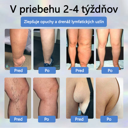 𝐴𝑇𝑇𝐷𝑋® 𝐵𝑦𝑙𝑖𝑛𝑛ý 𝑢𝑝𝑜𝑘𝑜𝑗𝑢𝑗ú𝑐𝑖 𝑘𝑟é𝑚 𝑝𝑟𝑜𝑡𝑖 𝑜𝑝𝑢𝑐ℎ𝑜𝑚 𝑠 č𝑖𝑒𝑟𝑛𝑜𝑢 𝑟𝑎𝑠𝑐𝑜𝑢