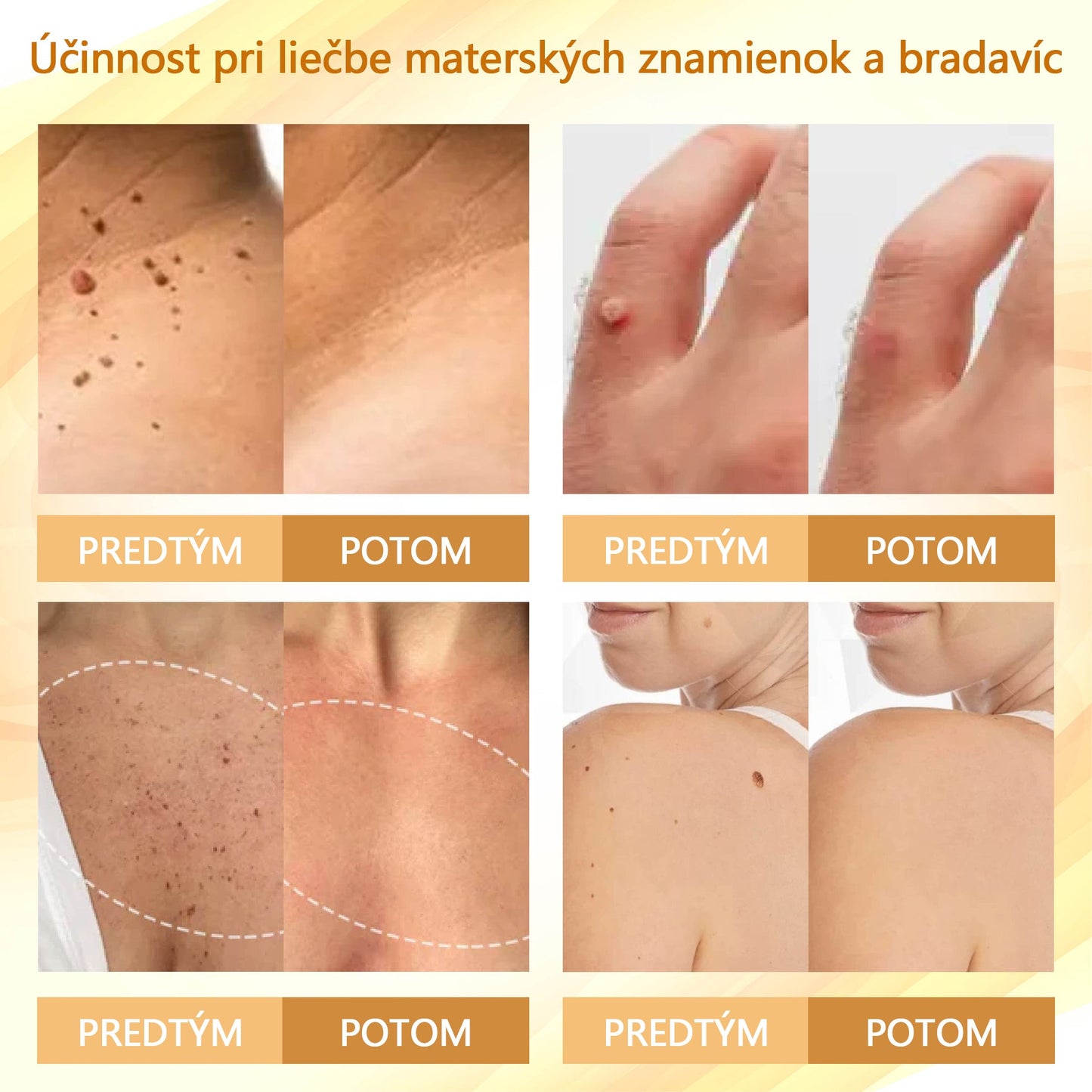 Regeneračný krém Croaie® Condense Mellifera Venom🔥